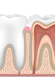 illustration of roots in tooth
