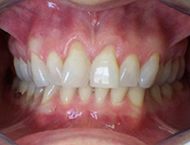 DMC Dental Invisalign