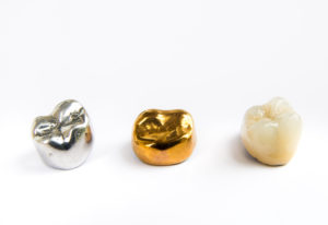 Gold, silver and white dental crowns